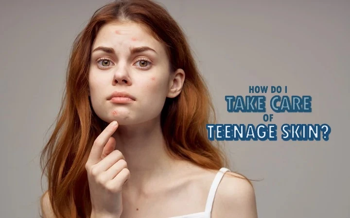 How do i take care of teenage skin?